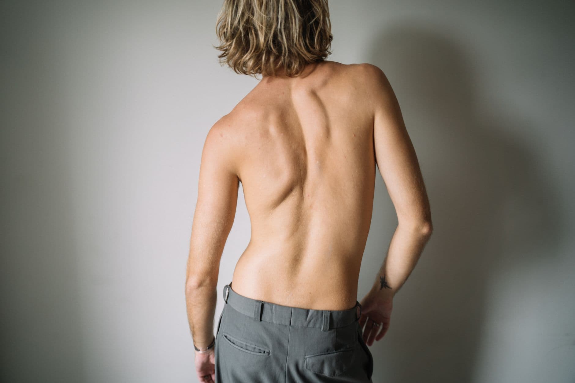 Expert orthopedic insights from Mountain Spine & Orthopedics - How to Know If You Have Scoliosis: The Signs to Check and What Confirms It