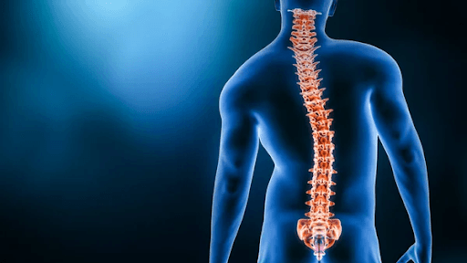 Expert orthopedic insights from Mountain Spine & Orthopedics - What Degree of Scoliosis Requires Surgery? The Four Findings That Actually Decide It
